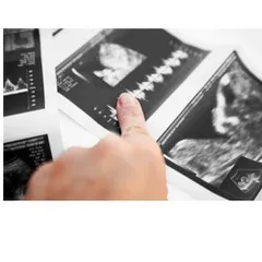 actaprint baby scan image
